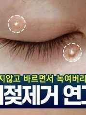 담다다담 쥐젖 크림 더마클리어스팟크림_20ml (카톤발주용)