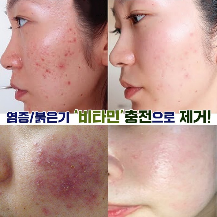 까레넬 히아루 비타5 시카세럼 30ml