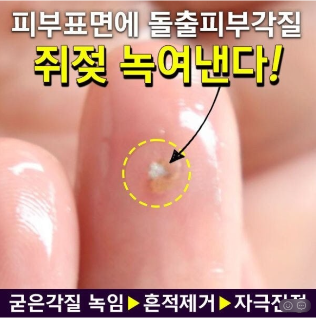 상품코드 : DD004 담다다담 쥐젖 크림 더마클리어스팟크림_20ml (카톤발주용)